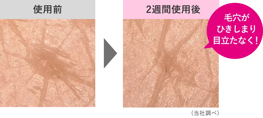 使用前と2週間使用後の同じ毛穴を測定。