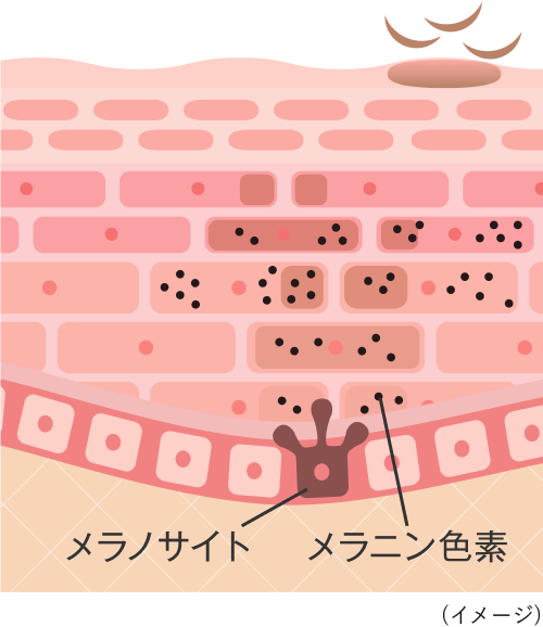 メラニンが減少