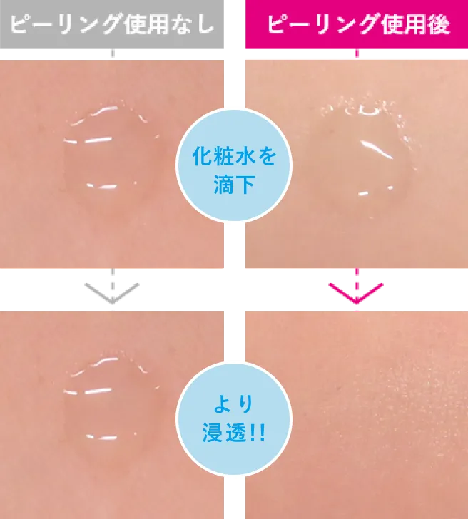 ピーリング使用なし→ピーリング使用後