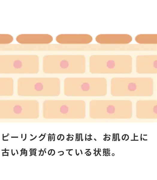 ピーリング前のお肌は、お肌の上に古い角質がのっている状態。