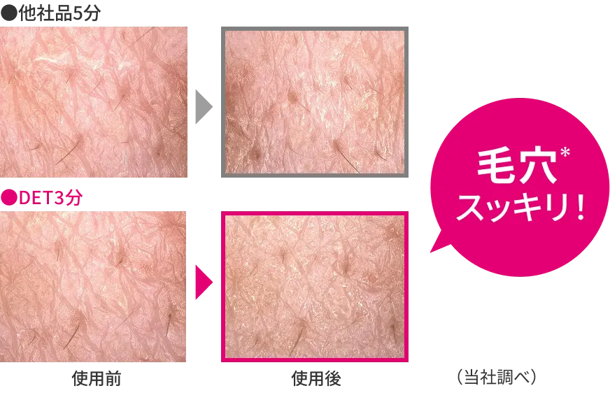 毛穴スッキリ!