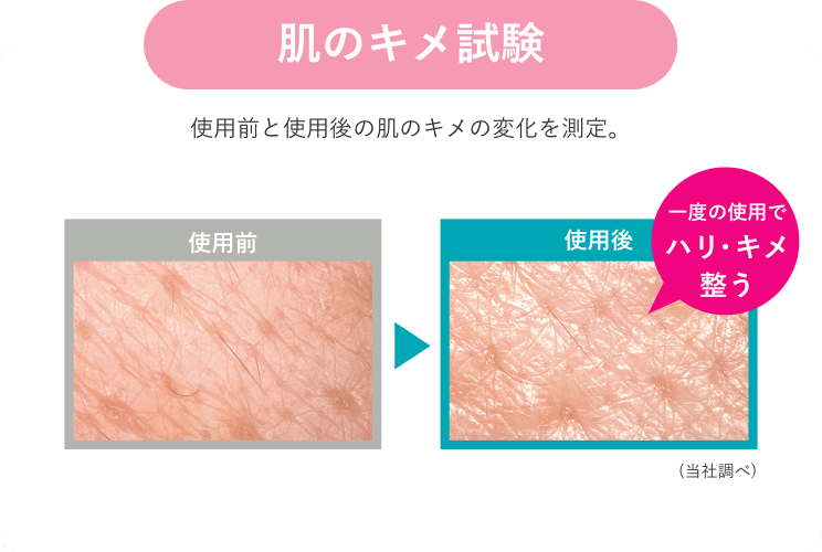 肌のキメ試験