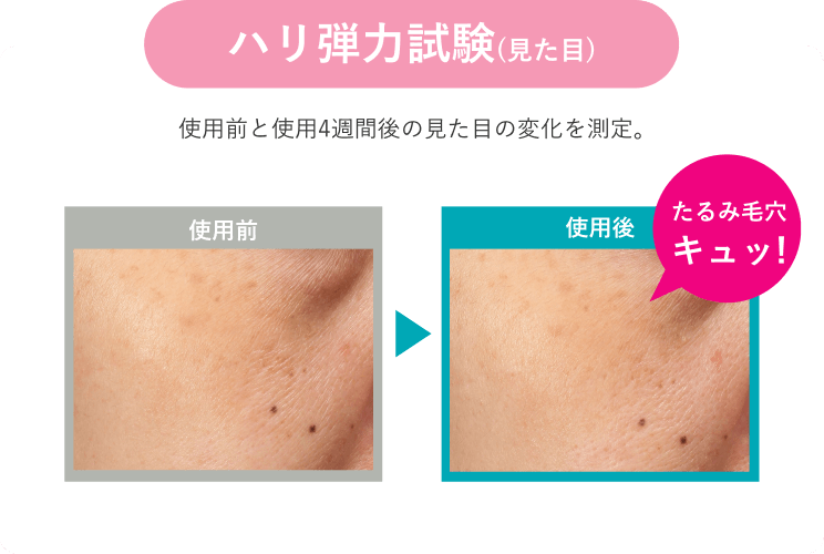 ハリ弾力試験(見た目)