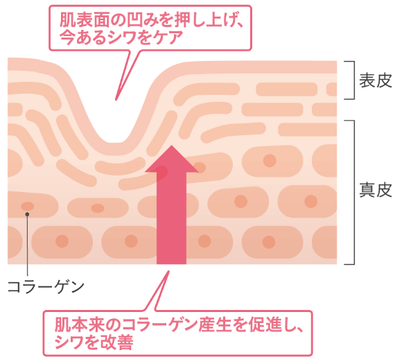 シワ改善